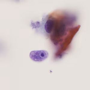 Case405_C.jpg