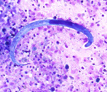 Case407_B.jpg