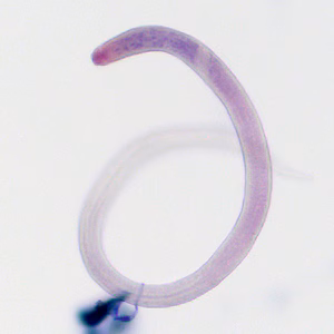 Case407_D.jpg