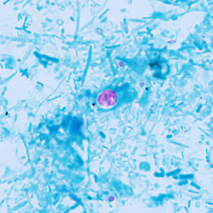 December - 2015 - Case #409