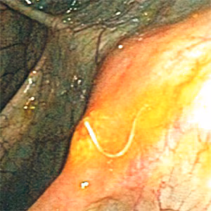 Case411_A.jpg Figure A