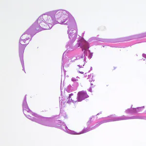 Case411_E.jpg Figure E
