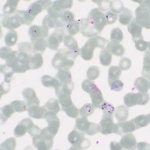 Case413_C.jpg Figure C