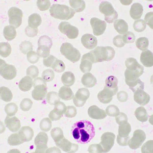 Case413_E.jpg Figure E