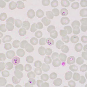 Case413_F.jpg Figure F