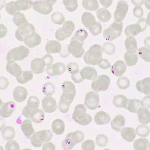 Case413_H.jpg Figure H