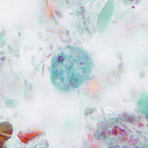 Case414_A.jpg