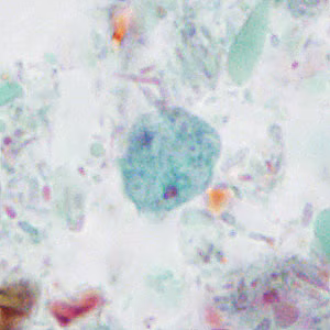 Case414_B.jpg