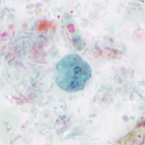 Case414_C.jpg