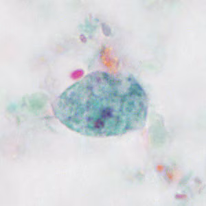 Case414_D.jpg
