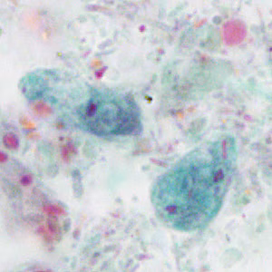 Case414_E.jpg