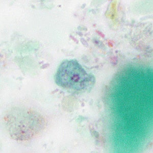 Case414_F.jpg