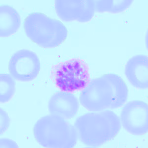 Case418_A.jpg