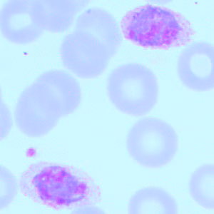Case418_B.jpg