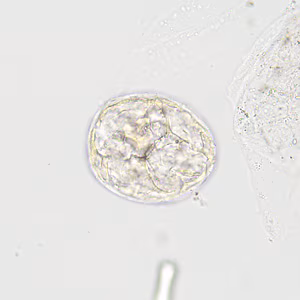 Case422_A.jpg