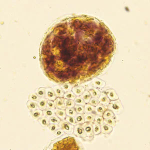 Case422_E.jpg