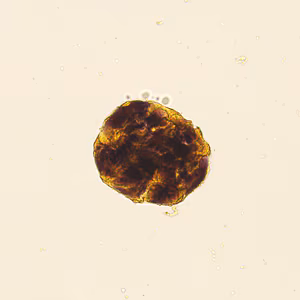Case422_F.jpg