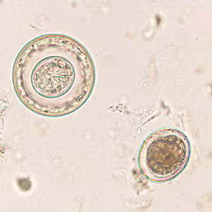 Case425_C.jpg