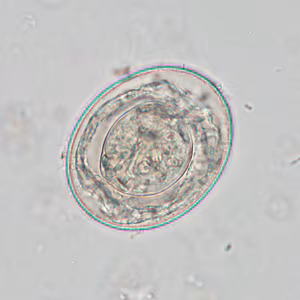 Case425_F.jpg