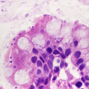 Case428_A.jpg