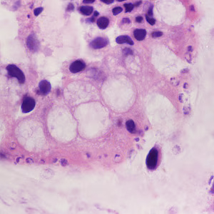 Case428_B.jpg