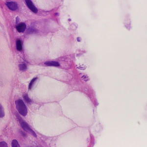 Case428_C.jpg