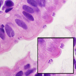 Case428_D.jpg