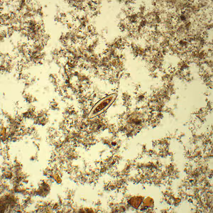 Case433_A.jpg