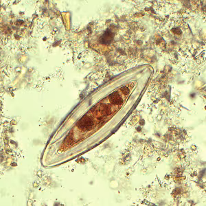 Case433_B.jpg