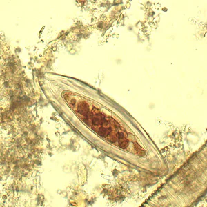Case433_C.jpg
