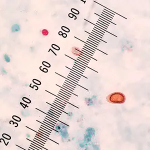Case434_B.jpg