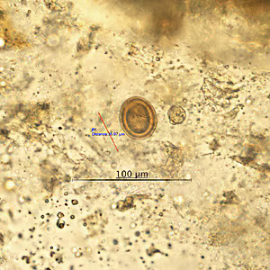 Case438_B