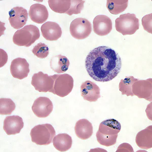 Case439_B