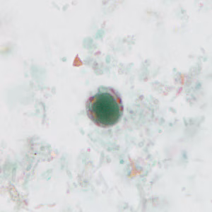 case440_A