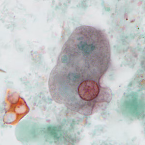 case440_B