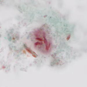 case440_C2