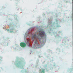case440_D1