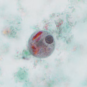 case440_D2