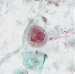 case440_E1