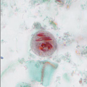 case440_E2
