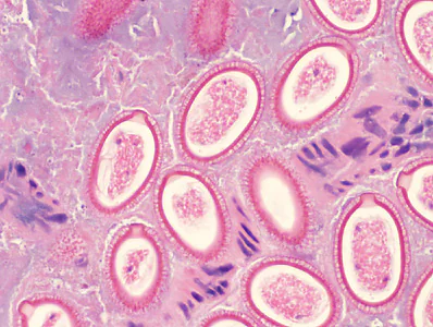 Case442_B