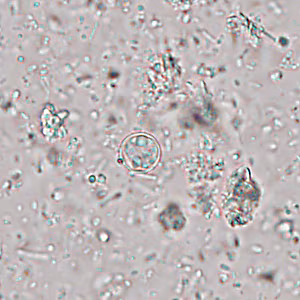 Case445_B Case445