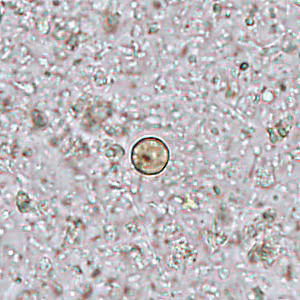Case445_C Case445