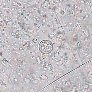 Case445_D Case445