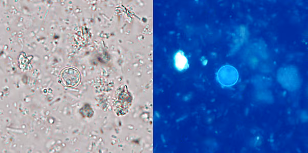 Figure B