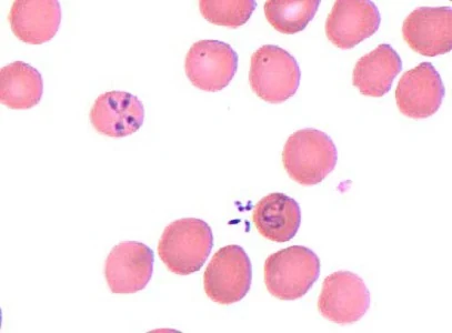 Case453_C parasitic image