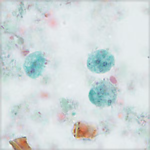 parasitic image
