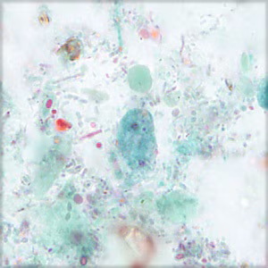 parasitic image