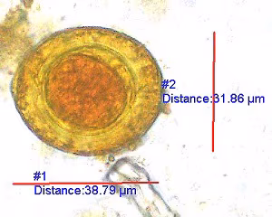parasitic image