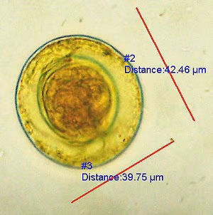 Case457_B.jpg parasitic image